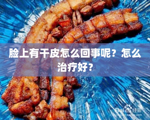 脸上有干皮怎么回事呢？怎么治疗好？