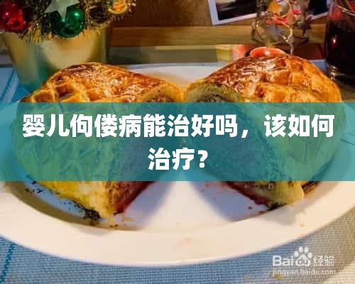 婴儿佝偻病能治好吗，该如何治疗？