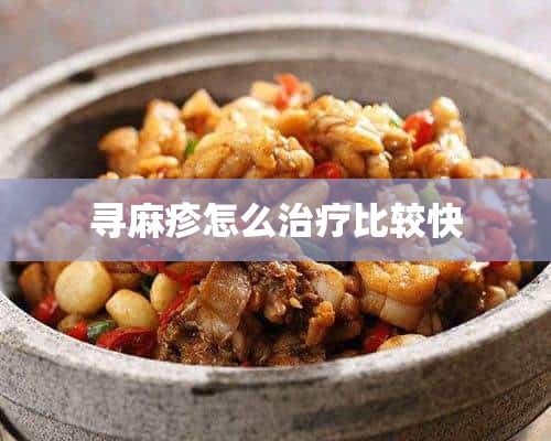 寻麻疹怎么治疗比较快